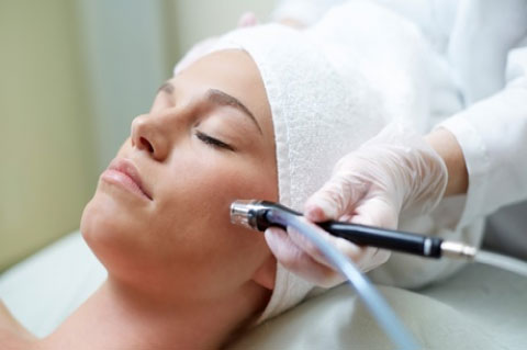 Microdermabrasion Acne Treatment additional image